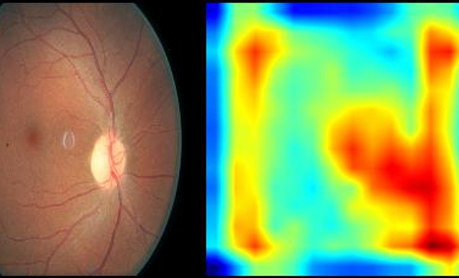 An output of the VISION-DR model when presented with a retinal image.